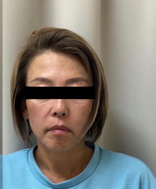 4CUS 4回目のときの正面写真